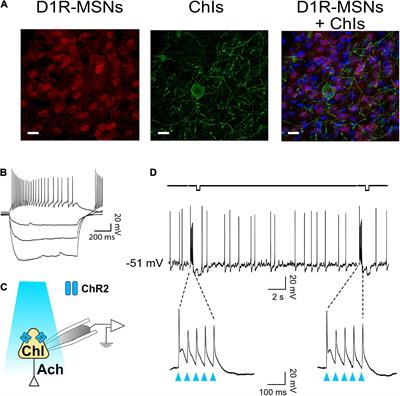 Binge alcohol drinking alters the differential control of cholinergic interneurons over nucleus accumbens D1 and D2 medium spiny neurons